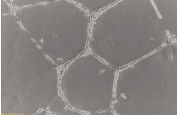 內(nèi)皮管形成測定