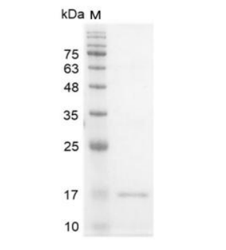 重組人IFNγ/干擾素γ, 無(wú)動(dòng)物源&無(wú)載體蛋白