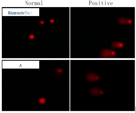 彗星試劑盒檢測Jurkat細(xì)胞的DNA 損傷