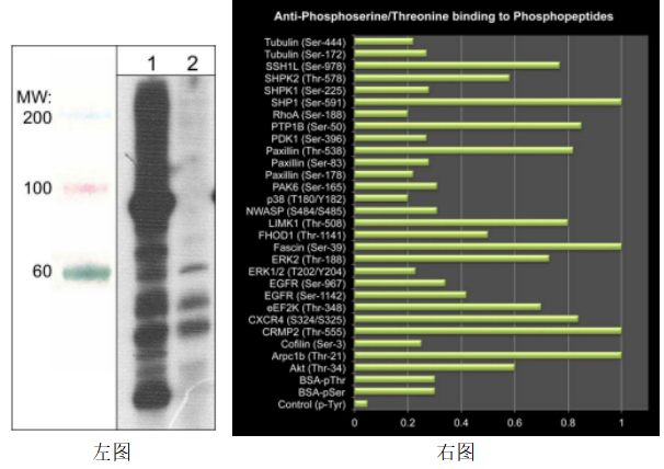 Anti-Phosphoserine/threonine（通用磷酸化抗體-抗磷酸化絲氨酸/蘇氨酸）