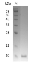 重組人MIF的SDS-PAGE分析