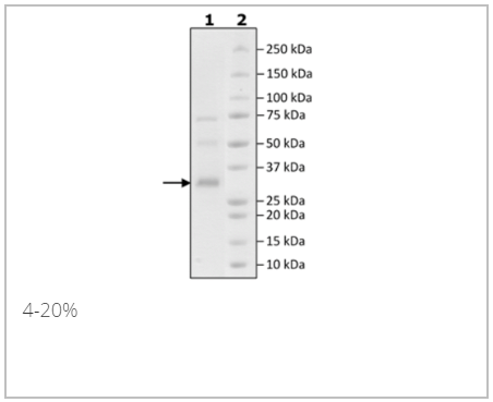 PSMA, His-Avi-Tag重組蛋白