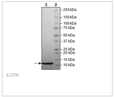 Ubiquitin, His-Tag重組蛋白