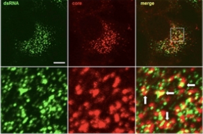 抗雙鏈RNA單克隆抗體J2