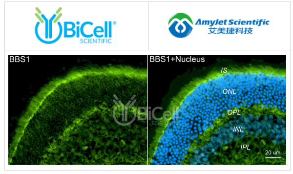 BBS1抗體（N末端）染色