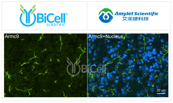 Bicell Scientific-ARMC9抗體染色