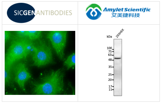山羊抗波形蛋白多克隆抗體圖例