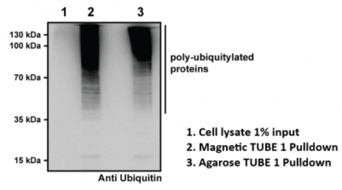 泛素/泛素化蛋白，親和磁珠