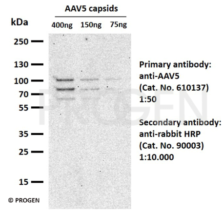 WB含有抗AAV5抗體