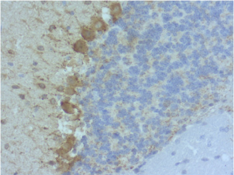 谷氨酸脫羧酶抗體IHC-P