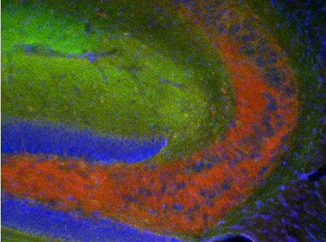 谷氨酸脫羧酶抗體IHC