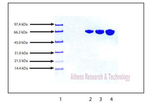 人血漿轉(zhuǎn)鐵蛋白
