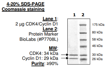 CDK4(EE,T172A)/Cyclin D1, His-tag 重組蛋白