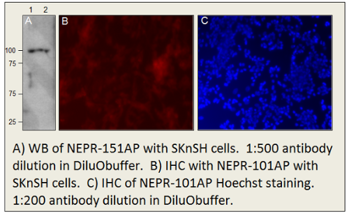 FabGennix-CD10抗體