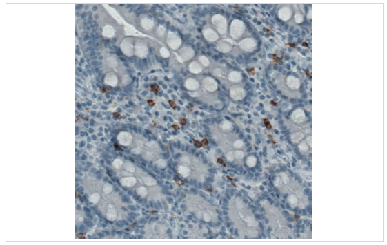 Atlas antibodies抗KIT抗體