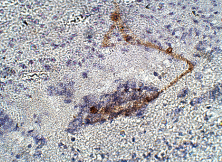 RIP140抗體ChIP等級(jí)