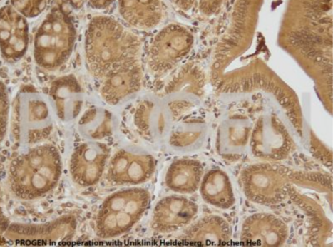 抗p62蛋白C末端,豚鼠pab