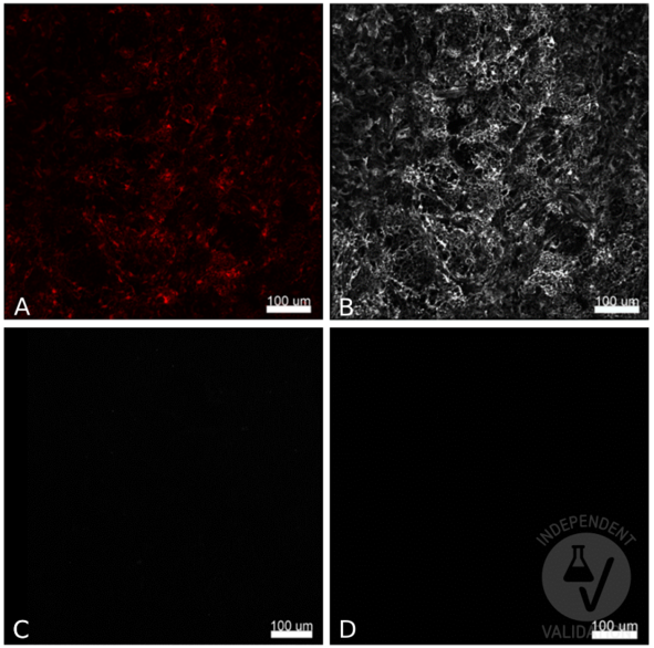 典型標(biāo)準(zhǔn)曲線