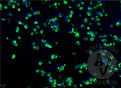 典型標(biāo)準(zhǔn)曲線