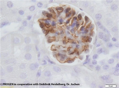 Nephrin豚鼠多克隆血清