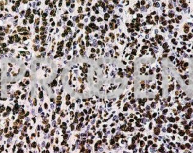 58-15識別核糖核蛋白（RNP）