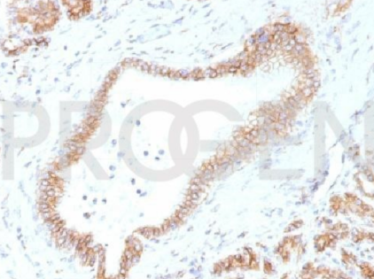 抗p120小鼠單克隆抗體,EBS-CA-011,純化