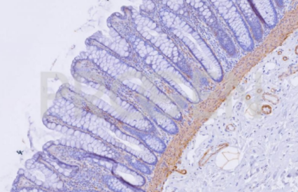 抗α平滑肌肌動(dòng)蛋白小鼠單克隆抗體，1A4/ASM-1，凍干，純化
