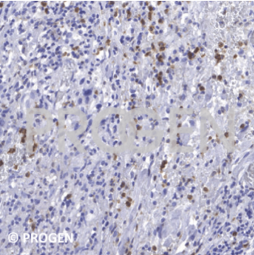 純化抗鈣衛(wèi)蛋白S100A8/A9復(fù)合物小鼠單克隆抗體