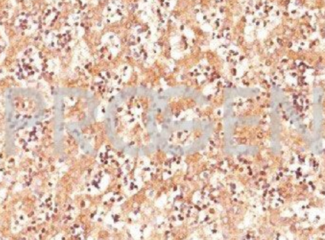 純化抗甲胎蛋白（AFP）小鼠單克隆抗體