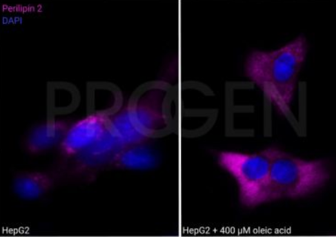 抗Perilipin 2抗體