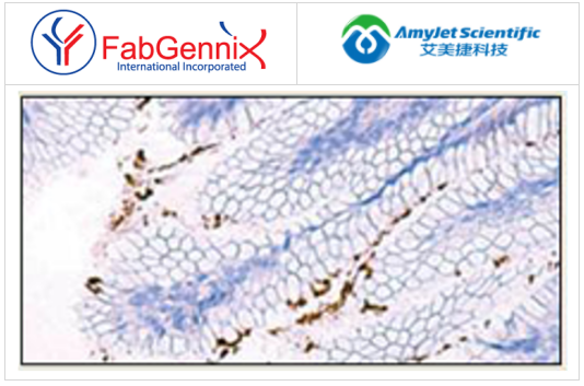 幽門(mén)螺桿菌抗體