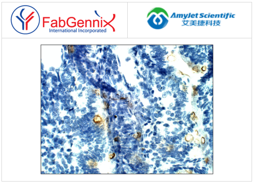 葡萄糖-6-磷酸催化亞基抗體