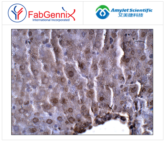 脂聯(lián)素抗體