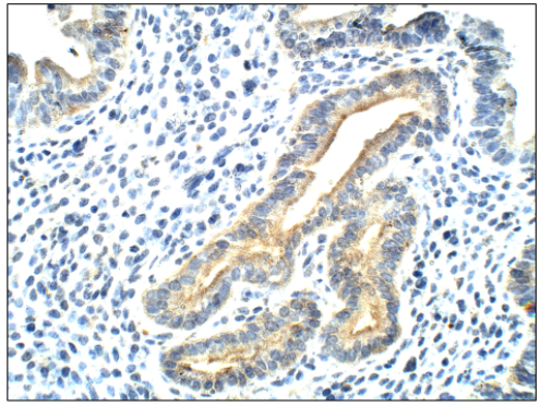 FabGennix-SOCS3抗體