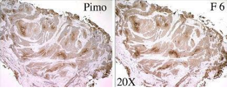 Hypoxyprobe低氧探針Gemini試劑盒