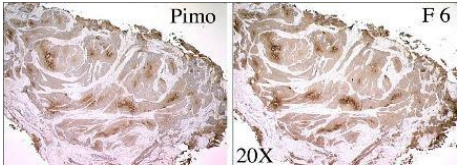 Hypoxyprobe-F6 (CCI-103F)