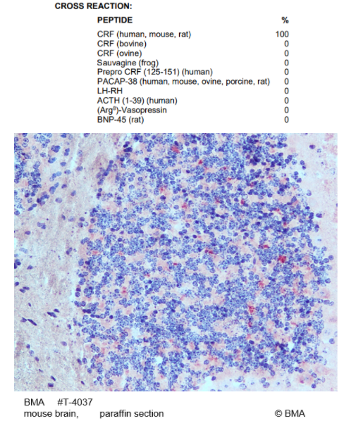 促腎上腺皮質(zhì)激素釋放因子（CRF），純抗血清多克隆抗體