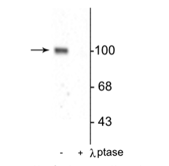 抗GluR1亞基（Ser845）抗體