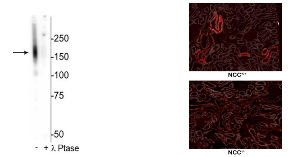 抗NCC（噻嗪敏感NaCl共轉(zhuǎn)運(yùn)體）（Thr53）抗體