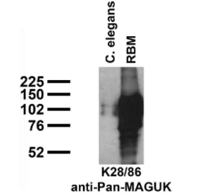 用K28/86 TC supe探針對(duì)成年大鼠（RBM）的秀麗隱桿線蟲粗提取物和粗腦膜進(jìn)行免疫印跡