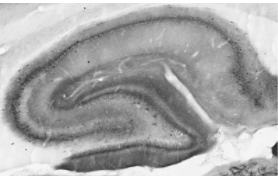 成年大鼠海馬免疫組織化學(xué)