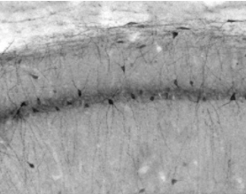抗Slo2.2/Slack K+通道抗體