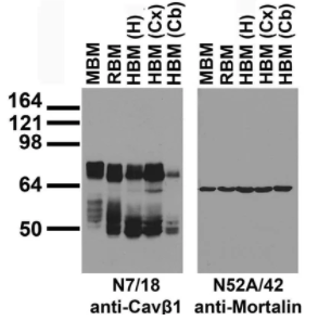 抗鈣通道抗體（N7/18）