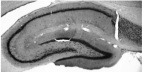 抗CV1.2鈣通道抗體
