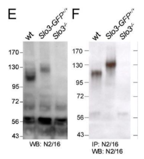 來(lái)自NeuroMab的抗KCNU1/Slo3 pH敏感的maxi-K+通道小鼠單克隆一抗是由雜交瘤克隆N2/16在內(nèi)部生產(chǎn)的。它經(jīng)過(guò)KO驗(yàn)證，檢測(cè)小鼠、爪蟾KCNU1/Slo3 pH敏感的最大K+通道，并通過(guò)蛋白A色譜純化。它非常適合在EM、ICC、IP、WB中使用。     艾美捷NeuroMab抗KCNU1/Slo3 pH敏感性Maxi-K+通道抗體（N2/16）：  貨號(hào) 75-056  目標(biāo)：KCNU1/Slo3 pH敏感型最大K+通道  目標(biāo)描述：由KCNU1基因編碼的鉀鈣激活通道亞家族U成員1是鉀通道家族的一員，屬于鈣激活的（TC 1.A.1.3）亞家族，KCa5.1/KCNU1次亞家族。KCNU1是一個(gè)睪丸特異性的鉀通道，通過(guò)細(xì)胞內(nèi)pH和膜電壓激活，介導(dǎo)K+的運(yùn)輸。KCNU1在睪丸中表達(dá)。與KCNU1相關(guān)的疾病包括腦白質(zhì)營(yíng)養(yǎng)不良、低髓鞘化3型和Coffin-Siris綜合征1型。  格式：通過(guò)蛋白A色譜法純化  濃度：1毫克/毫升  克隆性：?jiǎn)慰寺? 克隆：N2/16  亞型：IgG1  應(yīng)用：電鏡（EM）、免疫細(xì)胞化學(xué)（ICC）、免疫沉淀（IP）、西方印跡（WB）  宿主物種：小鼠  基因名稱：Kcnu1 Kcnma3 Ksper Slo3  分子量：115千道爾頓  抗原：小鼠Slo3（訪問(wèn)號(hào)O54982）的融合蛋白氨基酸1052-1121，在大腸桿菌中重組產(chǎn)生  物種反應(yīng)性：沙鼠、小鼠  儲(chǔ)存：分裝后在-20°C以下長(zhǎng)期儲(chǔ)存。短期儲(chǔ)存在2-8°C。為了最大限度地恢復(fù)產(chǎn)品，取下蓋子前先離心管。  物理狀態(tài)：液體  生產(chǎn)說(shuō)明：通過(guò)體外生物反應(yīng)器培養(yǎng)雜交瘤細(xì)胞系，然后通過(guò)蛋白A親和色譜法生產(chǎn)。純化的單克隆抗體特異性抗體超過(guò)90%。  緩沖液：10 mM Tris，50 mM 氯化鈉，0.065% 疊氮化鈉 pH 7.4  稀釋范圍：WB: 1:500  偶聯(lián)物：未偶聯(lián)  特異性：未報(bào)告交叉反應(yīng)  質(zhì)量控制：每批新抗體都在過(guò)表達(dá)目標(biāo)蛋白的細(xì)胞上進(jìn)行質(zhì)量控制測(cè)試，并確認(rèn)給出預(yù)期的染色模式。  使用說(shuō)明：這些抗體用作研究實(shí)驗(yàn)室試劑，不用于人類診斷或治療試劑。  有效期：自收貨之日起24個(gè)月  運(yùn)輸：冰袋運(yùn)輸  同義詞：鉀通道亞家族U成員1（鈣激活鉀通道亞單位α-3）（鈣激活鉀通道，亞家族M亞單位α-3）（精子特異性堿化激活K(+)電流的孔形成亞單位）（KSper）（Slowpoke同源物3）（mSlo3）（pH敏感型最大鉀通道）  UniProt詳情：UniProt（人類）: A8MYU2  UniProt（免疫原物種）: O54982  71.png  免疫印跡與來(lái)自野生型（wt）、Slo3-eGFP和Slo3-/-敲除小鼠睪丸的（E）膜蛋白以及用N2/16探測(cè)的N2/16拉下的總睪丸蛋白的（F）免疫沉淀產(chǎn)物的比較。數(shù)據(jù)由Christopher Lingle（華盛頓大學(xué)）提供，并經(jīng)美國(guó)國(guó)家科學(xué)院院刊許可轉(zhuǎn)載（2011 Zeng等人，PMID 21427226）。     NeuroMab 旨在構(gòu)建一個(gè)新的神經(jīng)元蛋白庫(kù)。NeuroMab專注于研究膜蛋白（受體/通道/轉(zhuǎn)運(yùn)）、突觸蛋白和其他神經(jīng)元信號(hào)分子。隨后，NeuroMab逐漸擴(kuò)大了其產(chǎn)品線的范圍，現(xiàn)在涵蓋了神經(jīng)科學(xué)和生物醫(yī)學(xué)基礎(chǔ)研究的其他領(lǐng)域。NeuroMab為哺乳動(dòng)物大腦的生化和免疫組織化學(xué)實(shí)驗(yàn)提供低成本、高質(zhì)量的小鼠單克隆抗體。目前NeuroMab已經(jīng)開發(fā)了近500種抗體，其中許多已在小鼠腦中進(jìn)行了敲除驗(yàn)證。     艾美捷科技是NeuroMab的中國(guó)代理商，為科研工作者提供優(yōu)質(zhì)的產(chǎn)品與服務(wù)。