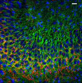 抗半胱氨酸-110/PSD-93抗體（N18/30）