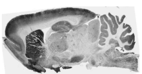 PTEN誘導(dǎo)的抗Pink1假定激酶1抗體（N4/15）