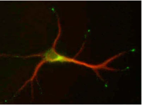 培養(yǎng)的海馬神經(jīng)元（9 DIV）MAP2（紅色）、L5/1（綠色）雙重染色