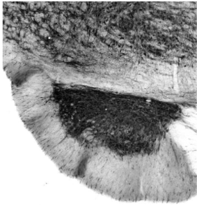 成年大鼠腦橋核免疫組織化學(xué)