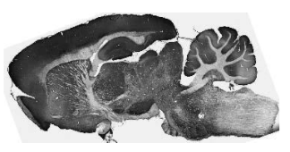 抗Kir2.3 K+通道抗體（N25/35）